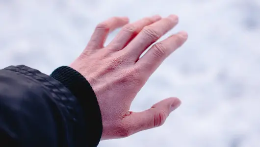 hand without mitten in winter
