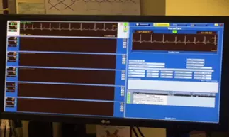 The new Cardiopulmonary Telemetry Monitoring System