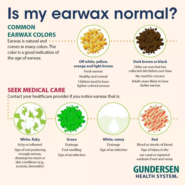 Is my earwax normal?  Gundersen Health System